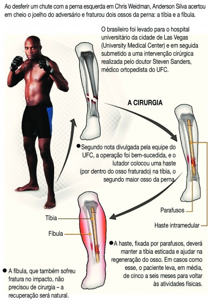 infografico anderson silva