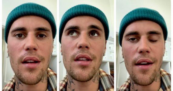 Com paralisia facial, Justin Bieber pede orações: ‘Eu confio em Deus'