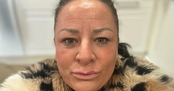 'Senti fogo por todo o meu corpo': mulher descreve libertação das drogas durante culto