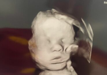 Mãe cristã mostra imagem da ‘mão de Deus’ sobre bebê em exame de ultrassom