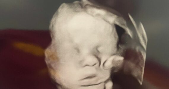 Mãe cristã mostra imagem da ‘mão de Deus’ sobre bebê em exame de ultrassom